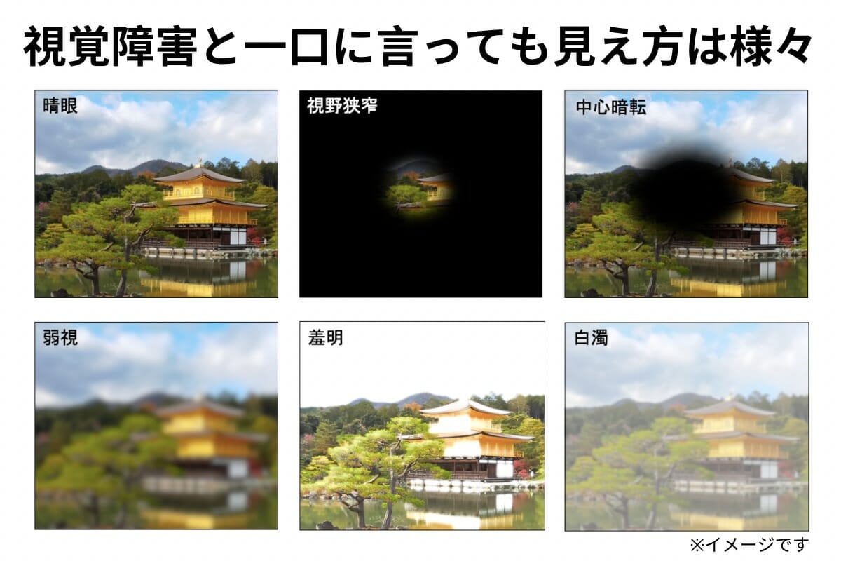 金閣寺の画像が6つ並んでいる。左上から晴眼、視野狭窄、中心暗転、左下から弱視(低視力)、羞明、白濁